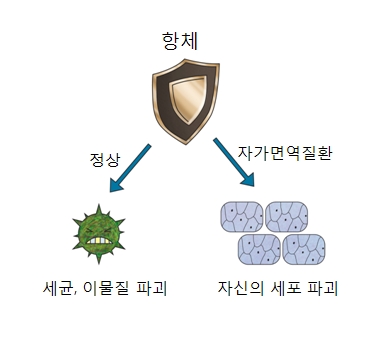 자가면역 질환