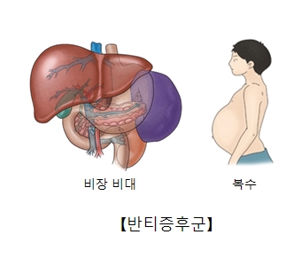 반티증후군