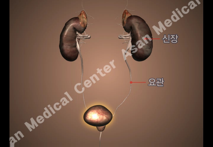 비임균성 요도염