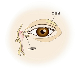 눈물흘림증