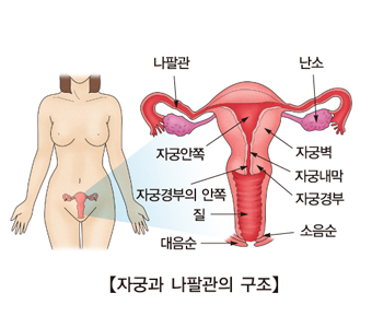 과립막 세포종